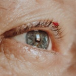Die besten Hausmittel gegen Bindehautentzündung: Natürliche Heilung für Ihre Augen