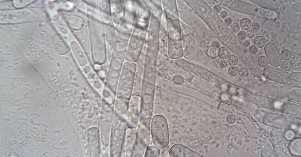 Die Auswirkungen von Schimmel auf die Gesundheit: Risiken und Prävention